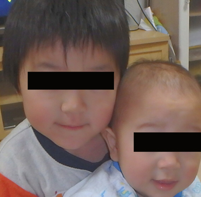 左が、マルチアレルギーのある長男5歳。右が、次男1歳。肌状態良好（アレルギーブログより）